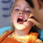 Почему разрушаются детские зубки?