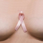Рак груди – самый частый рак у женщин
