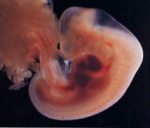 Эмбрион - 5 неделя