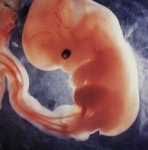 Эмбрион. Седьмая неделя беременности