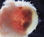 Эмбрион. 8 неделя